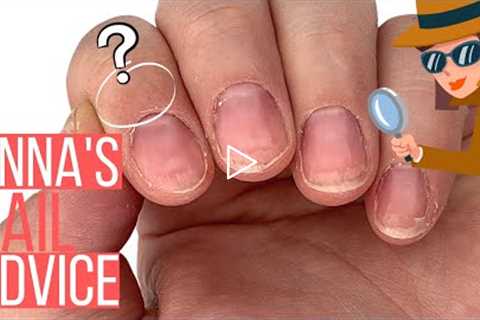 MY NAILS HURT AND SPLIT! ANNA, HELP! [ANNA'S NAIL ADVICE]