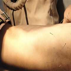 Discover How Electroacupuncture Supports Holistic Health in Portland